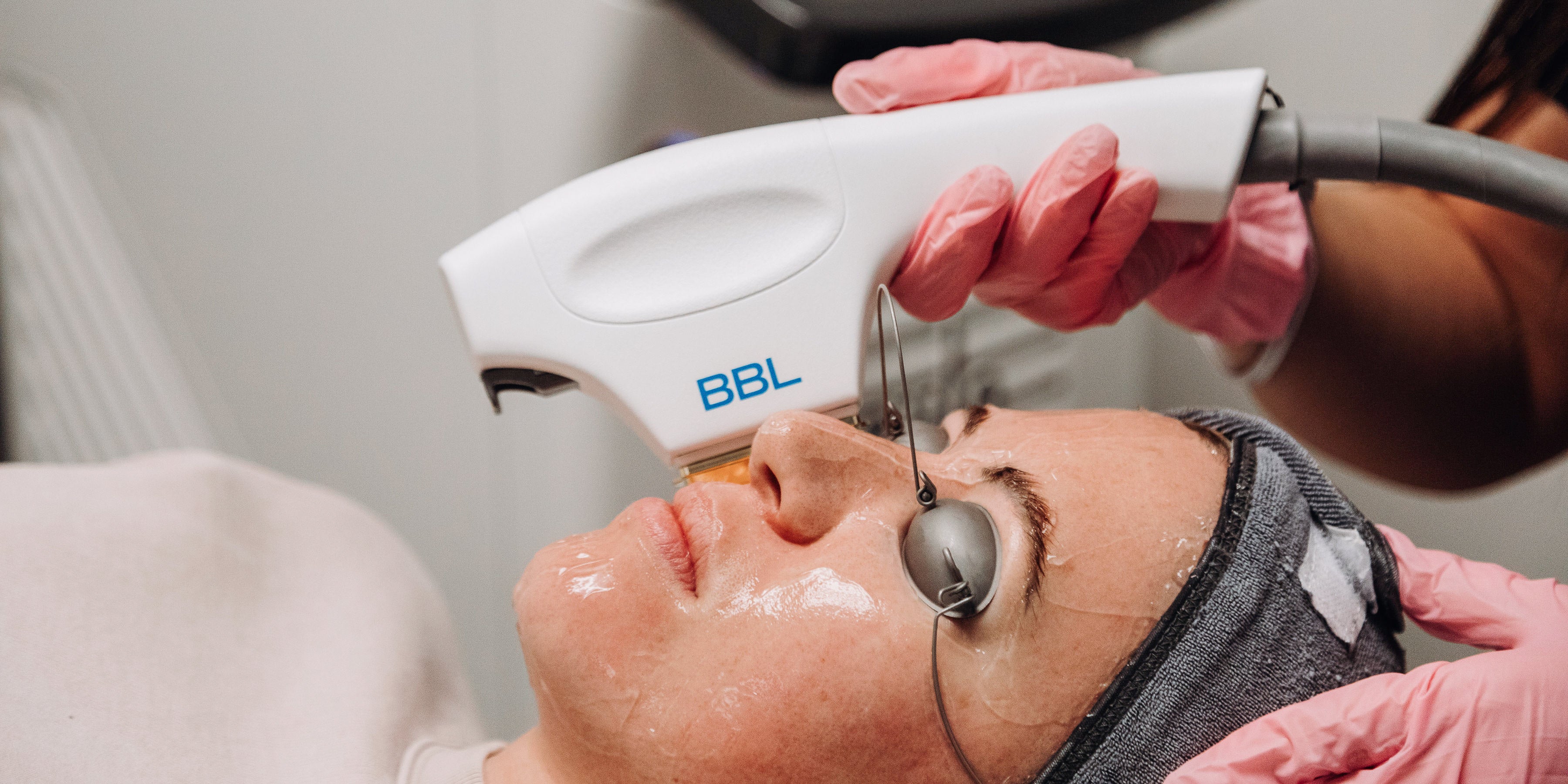 Woman receiving BBL laser treatment on her face.