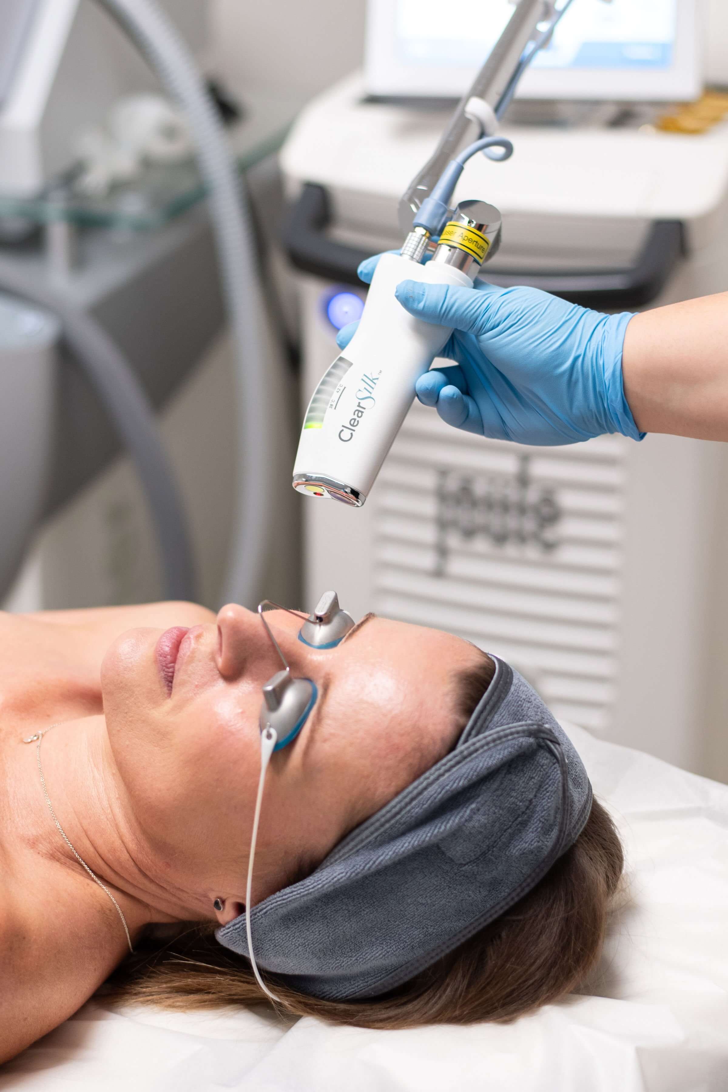 ClearSilk laser treatment being performed on a patient's face.