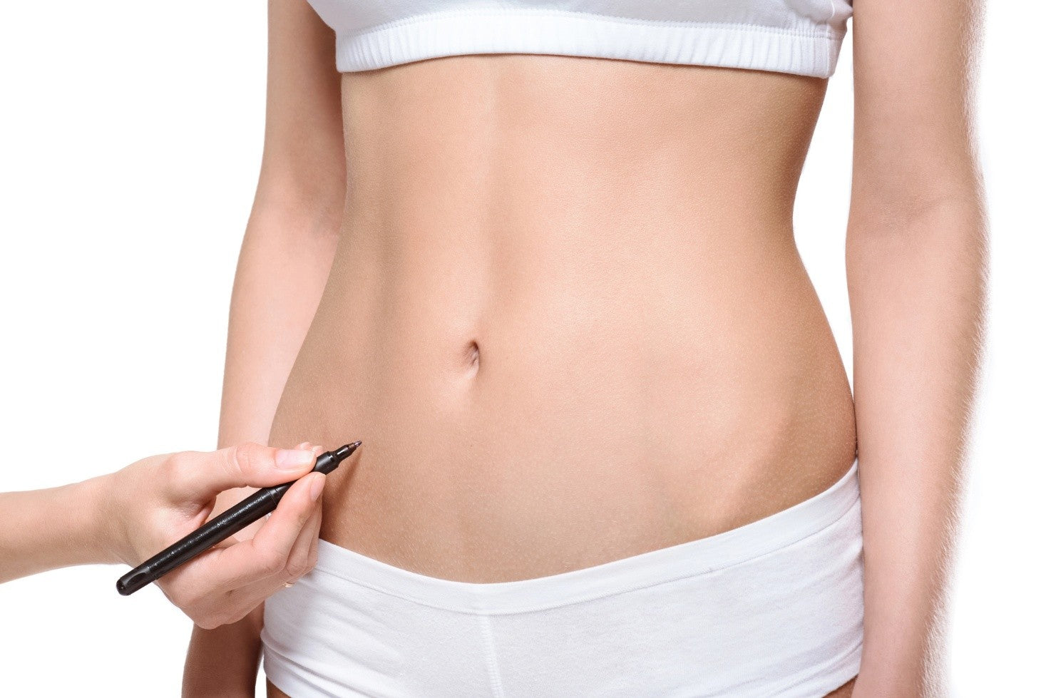 Abdomen of a woman being marked for a cosmetic procedure