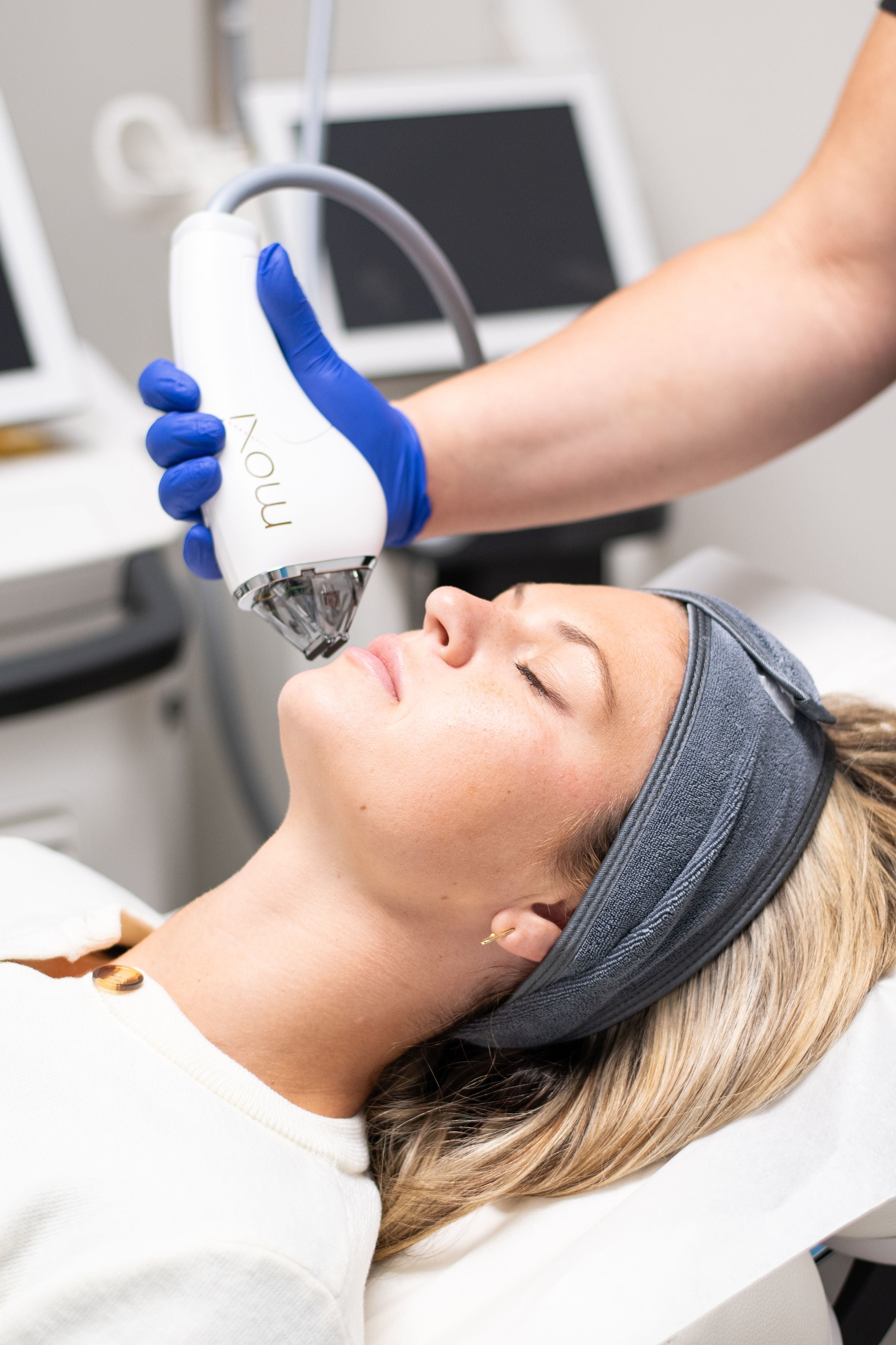 Moxi Laser in London, Ontario at London Plastic Surgery